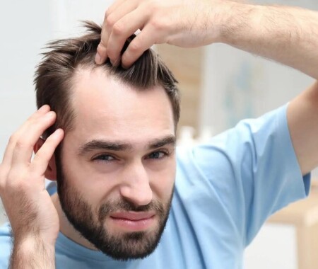 https://kyiv.alpha-medical.com.ua/ru/oblysenie-u-muzhchin-prichiny-i-metody-lecheniya-v-klinike-alpha-medical/